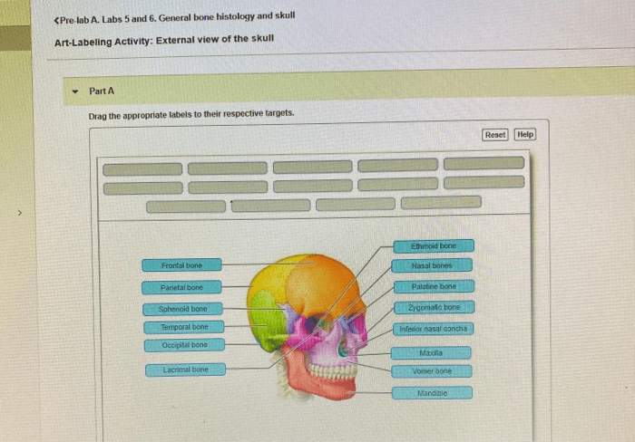 Art-labeling activity: external view of the skull